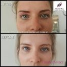 Microblading Before and After