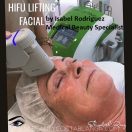 HIFU Lifting Facial